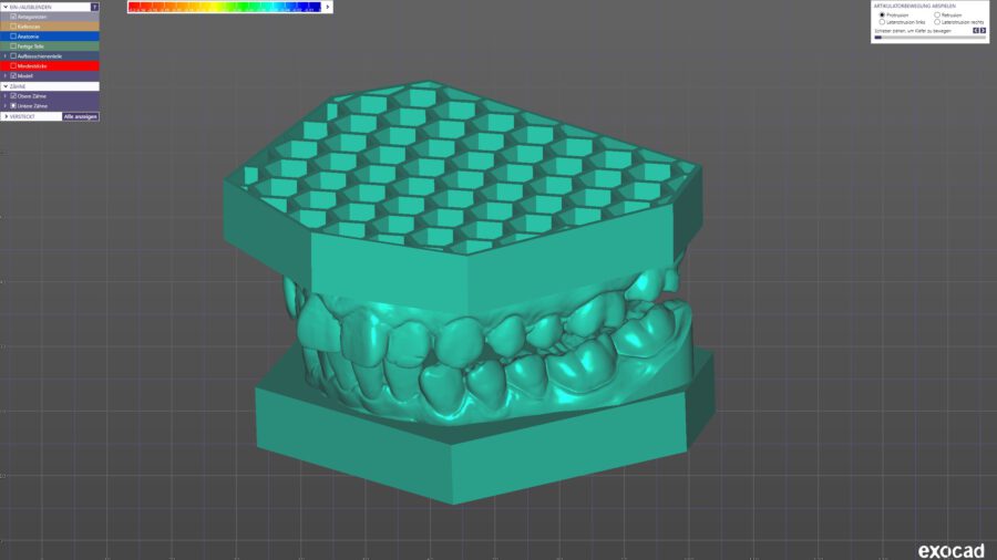 Orthodontic honeycomb baseplates for modelcreator / closed and drained